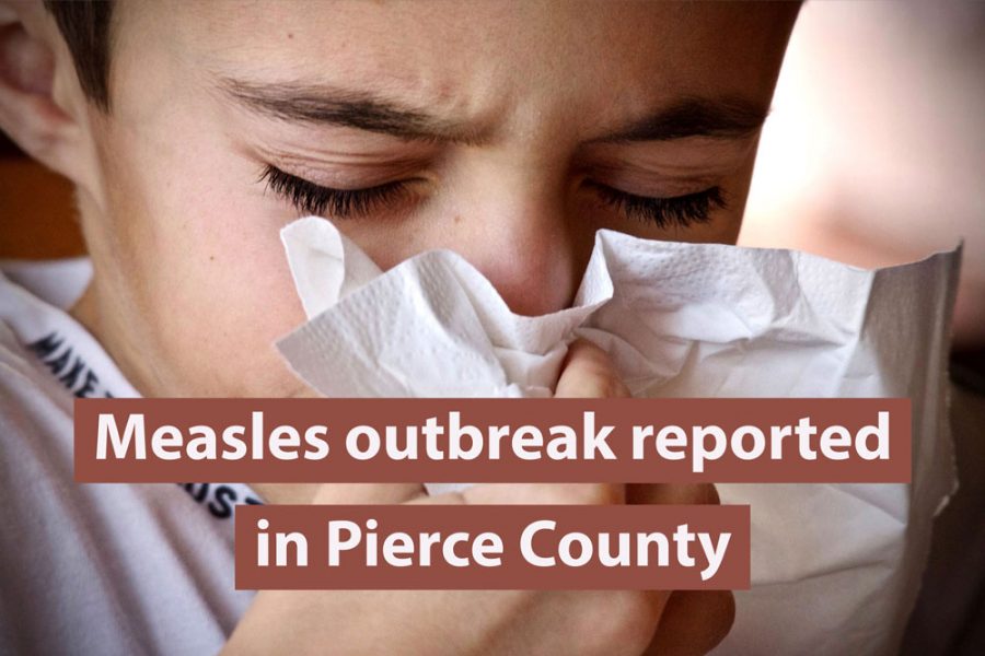 Measles outbreak reported in Pierce County